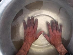 При обморожении пальцев рук помогают ванночки