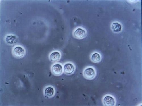 Лейкоциты под микроскопом