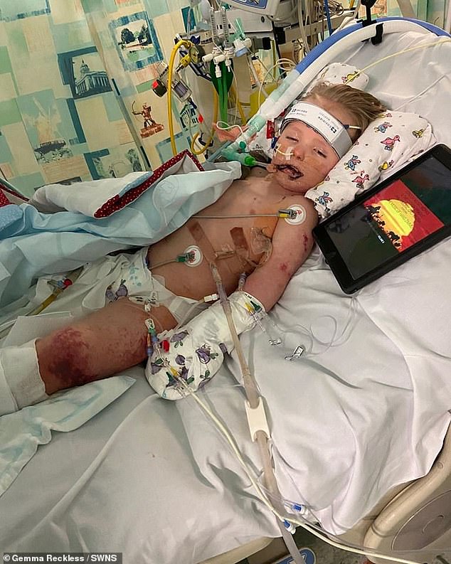The little boy became seriously ill in January after he developed sepsis while suffering from scarlet fever