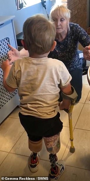William Reckless, 4, from Sutton-in-Ashfield, takes his first steps unaided after losing both his lower legs to sepsis