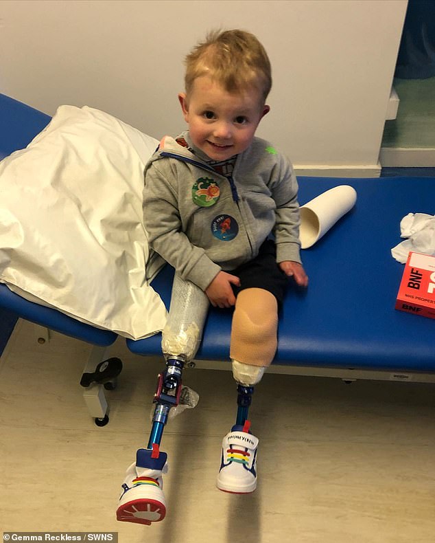 Smiling with his new legs: William Reckless, 4, with his prosthetics in hospital after sepsis stripped him of both limbs