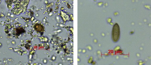 The images above show some of the microscopic fungal spores from grilled fungi (left) and bolete fungi (right) that the researchers found trapped inside the hardened dental plaque on the Red Lady of El Mirón