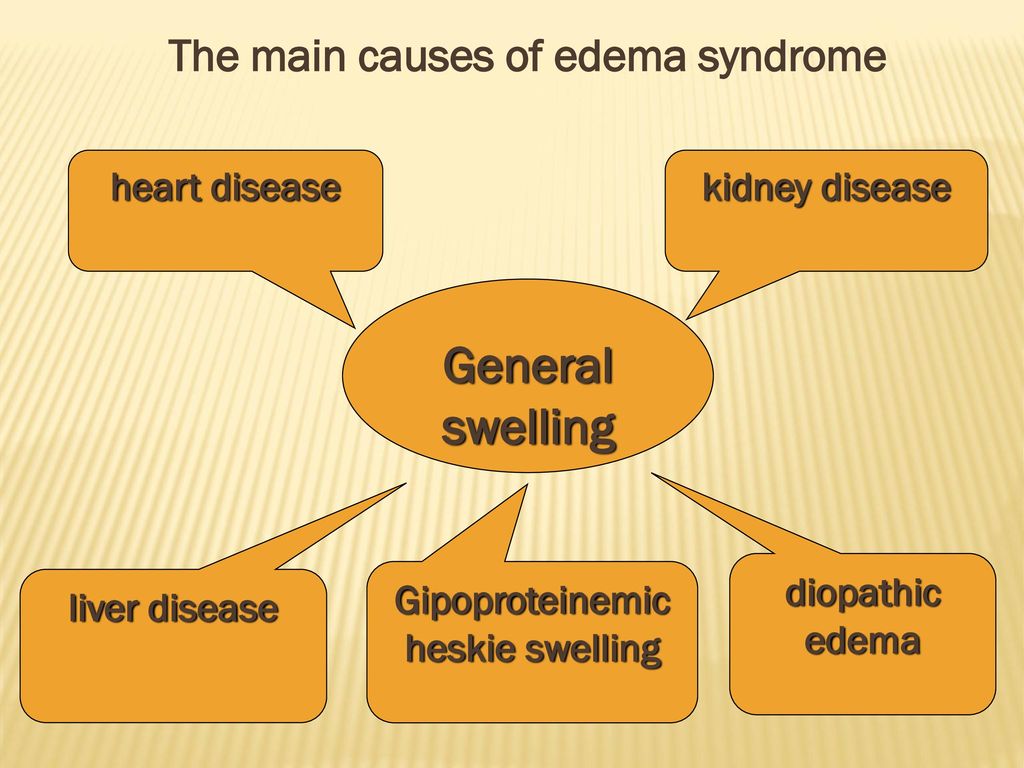 The main causes of edema syndrome Gipoproteinemicheskie swelling