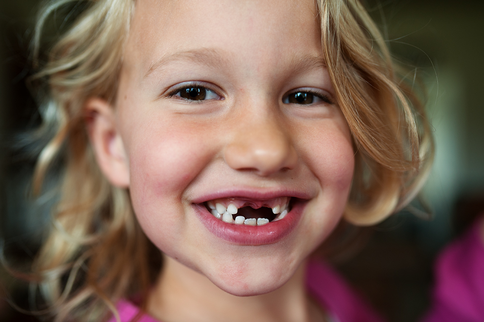 Потеря детских зубов: чего ожидать 