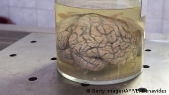 Человеческий мозг в формалине