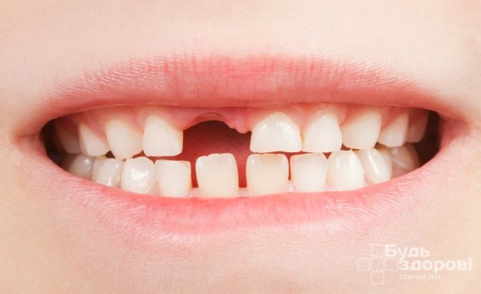 Период смены зубов у детей - с 4 до 13 лет
